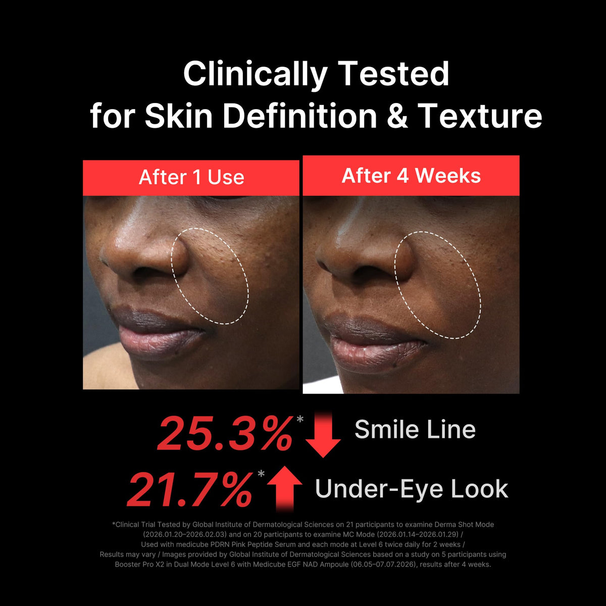 Medicube Booster Glow Beauty Device